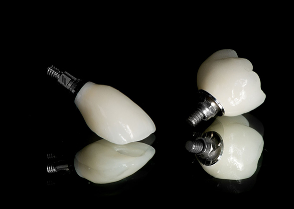 implant2