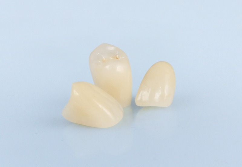 zirconia-2