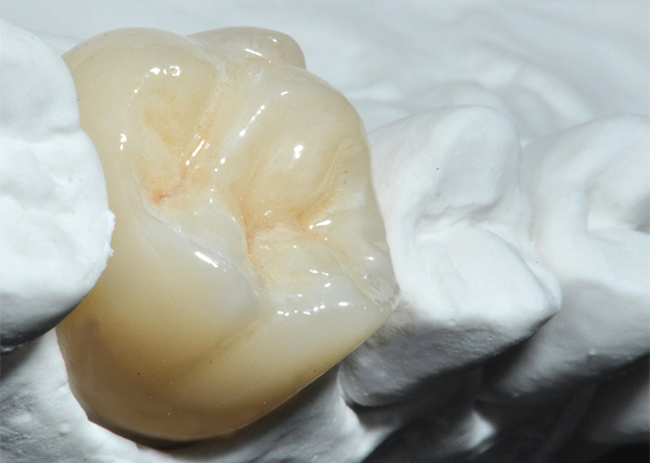 zirconia